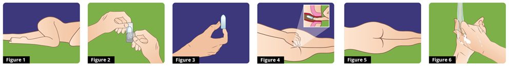 step by step instructions/directions for use Proctis-M suppository